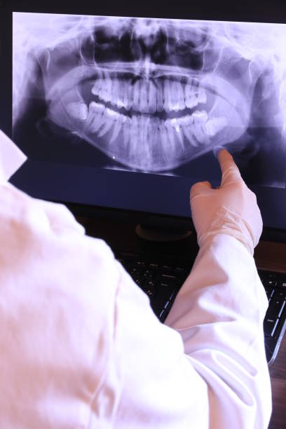 Best Dentist for Tooth Abscess  in Panama, OK