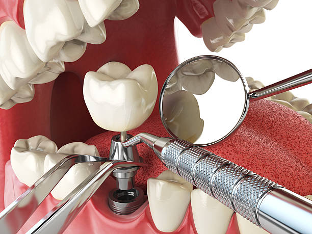 Emergency Dentist Open Today in OK